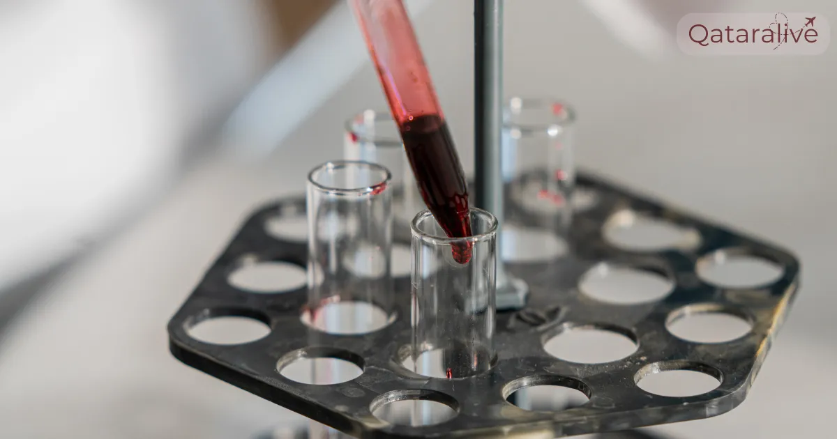 Premarital Medical Test in Qatar Complete Guide 4 premarital medical test 5. Blood sample - Qataralive